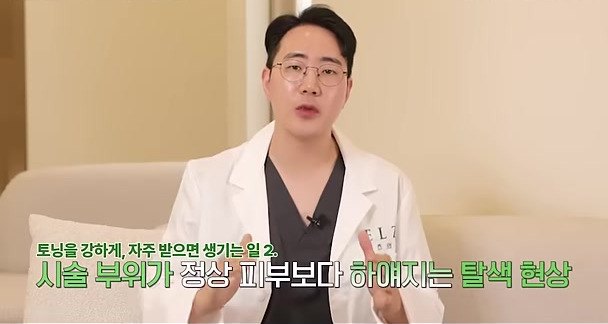 토닝을 강하게 자주 받으면 시술 부위가 정상 피부보다 하얘지는 탈색 현상이 나타날 수 있다고 설명하는 김영권 대표원장