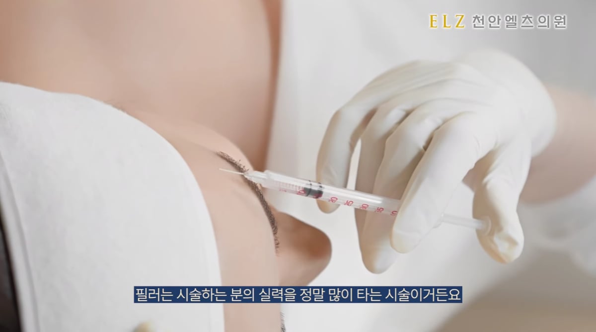 입술에 필러를 주입하는 시술 장면